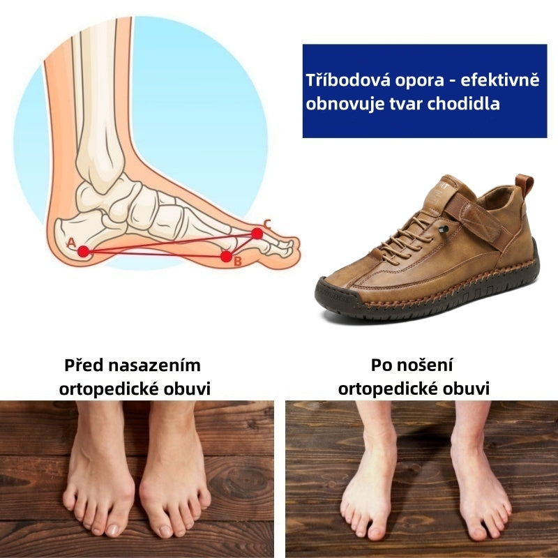 Poslední den! Sleva 70%! ✅ Vyrobeno z prémiové italské kůže. Ortopedická zdravotní obuv určená pro osoby s problémy s nohama k úlevě od bolesti zad, kloubů a chodidel.