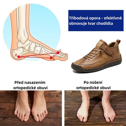 Poslední den! Sleva 70%! ✅ Vyrobeno z prémiové italské kůže. Ortopedická zdravotní obuv určená pro osoby s problémy s nohama k úlevě od bolesti zad, kloubů a chodidel.