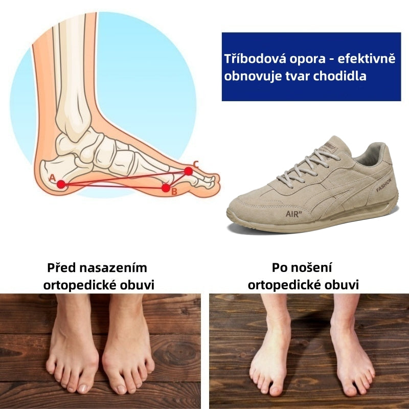 Poslední den! Sleva 70 %! ✅ Ortopedická zdravotní obuv určená speciálně pro lidi s problémy s nohama k úlevě od bolesti zad, kloubů a chodidel.