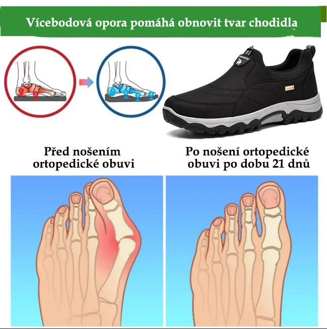 Pohodlná ortopedická obuv z semiše – měkká a pohodlná, s vynikající oporou – zmírňuje bolesti nohou.